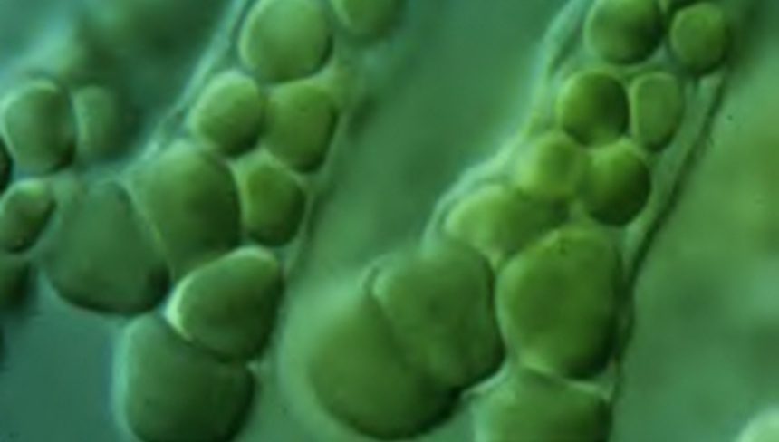 %d0%9a%d0%b0%d0%ba %d0%b1%d0%be%d1%80%d0%be%d1%82%d1%8c%d1%81%d1%8f %d1%81 %d1%81%d0%b8%d0%bd%d0%b5 %d0%b7%d0%b5%d0%bb%d0%b5%d0%bd%d1%8b%d0%bc%d0%b8 %d0%b2%d0%be%d0%b4%d0%be%d1%80%d0%be%d1%81%d0%bb%d1%8f%d0%bc%d0%b8